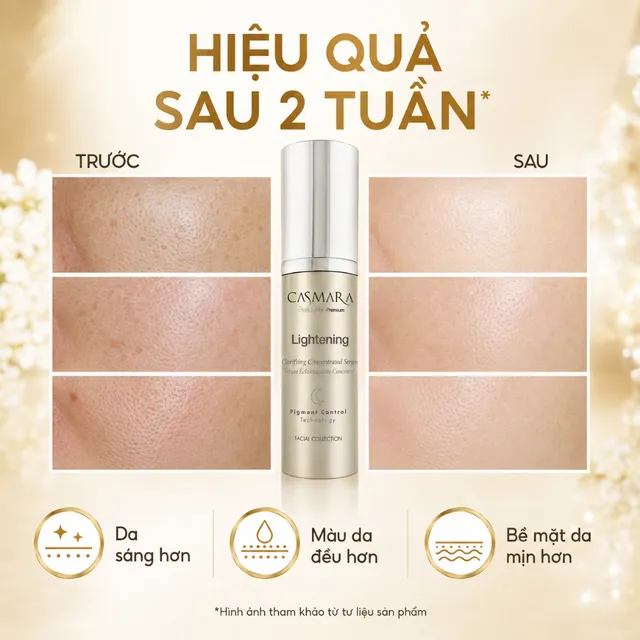 Mờ th&acirc;m n&aacute;m với Casmara
