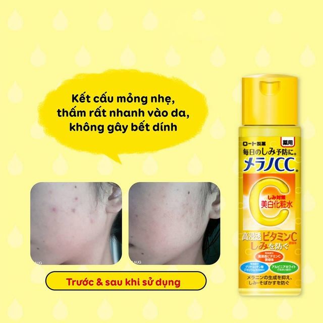 Nước hoa hồng CC Melano Rohto Lotion 170ml