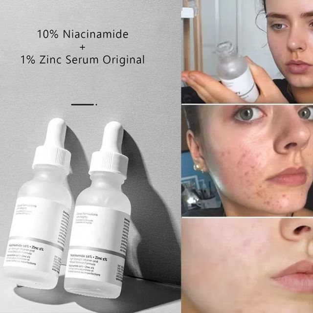 Serum The Ordinary Niacinamide 10% + Zinc 1%