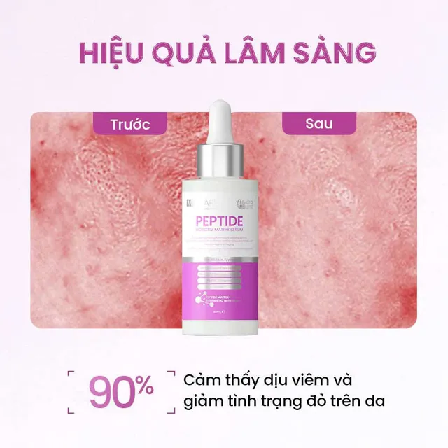 Serum giảm đỏ MD Care