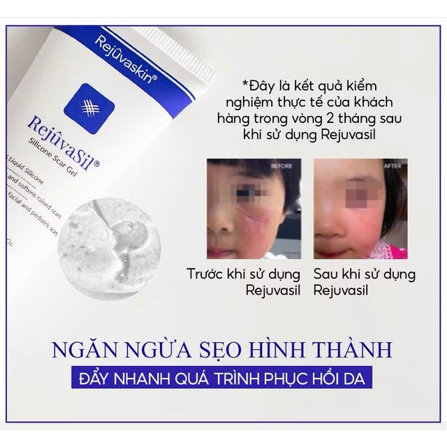 image product content 1