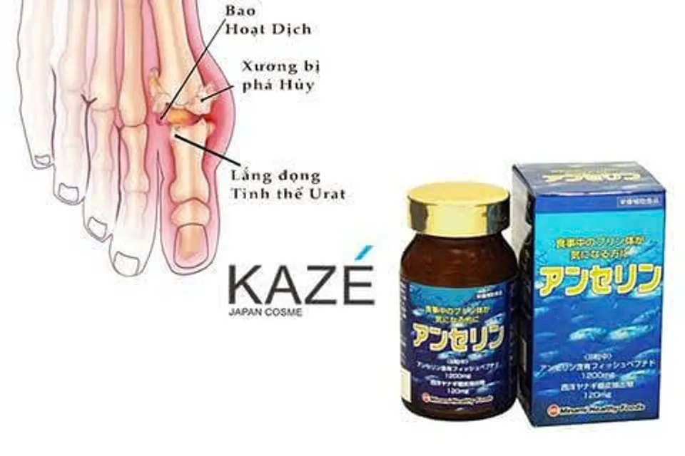 Vi&ecirc;n Uống vấn đề sức khỏe Anserine