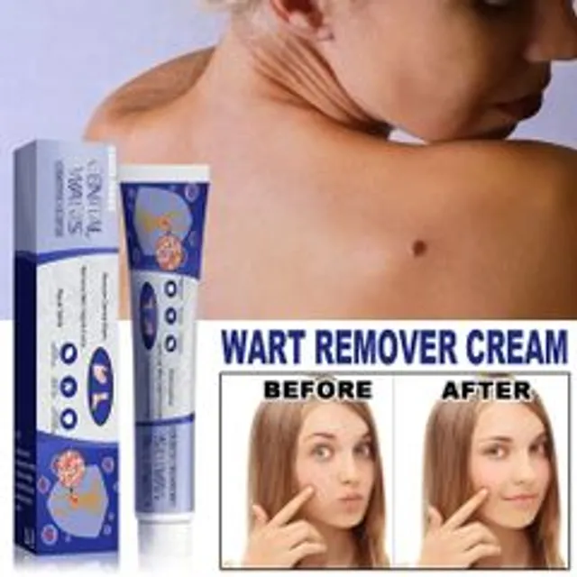 Kem B&ocirc;i Rụng Mụn Thịt Thừa & Mụn C&oacute;c