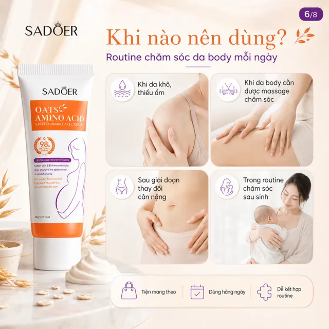 Kem x&oacute;a rạn da sau sinh