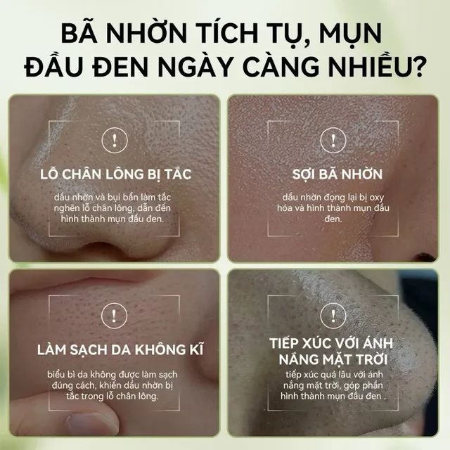 Gel Lột Mụn Than Tre OKESHOP