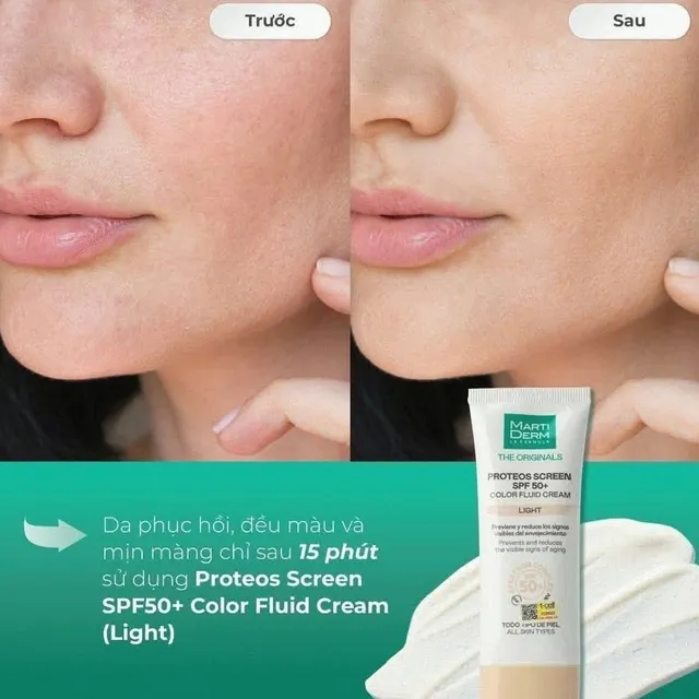Kem Chống Nắng Martiderm Proteos Screen SPF50+