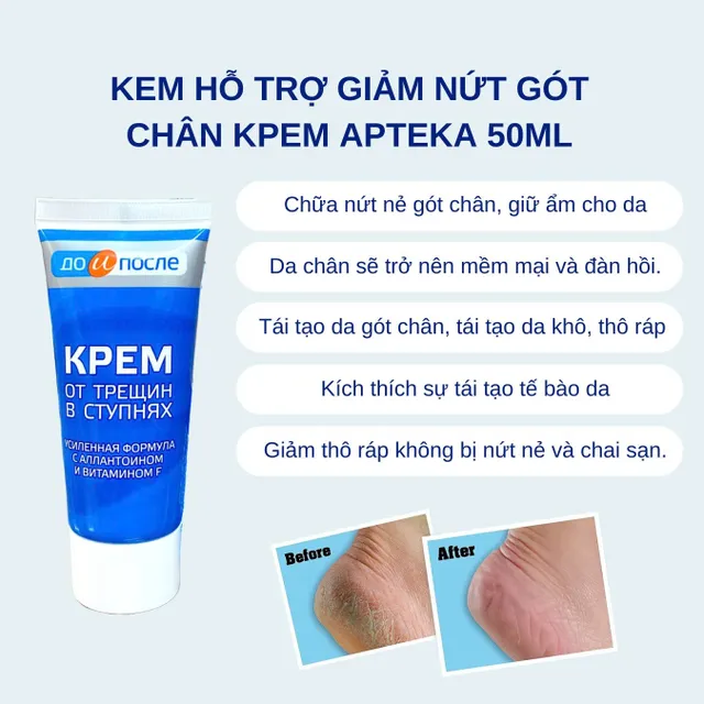 Kem Hỗ Trợ Giảm Nứt G&oacute;t Ch&acirc;n Dưỡng Mềm Mịn Kpem Apteka 50ml