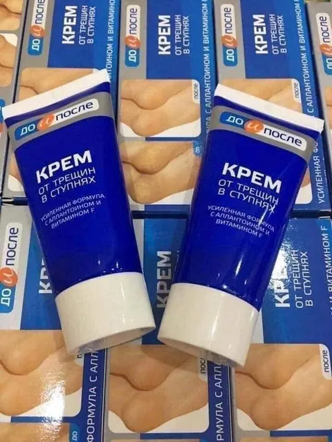 Kem Hỗ Trợ Giảm Nứt G&oacute;t Ch&acirc;n Dưỡng Mềm Mịn Kpem Apteka 50ml