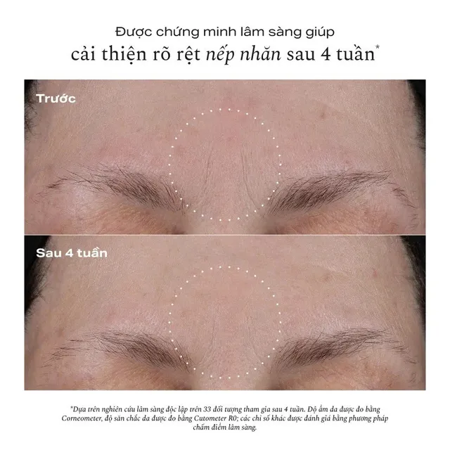 Kem dưỡng da Pro-Collagen