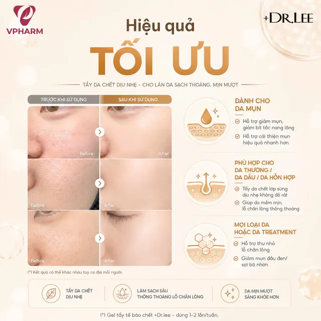 Sản phẩm Gel Tẩy Da Cngừng hẳn Sinh Học +Dr.lee