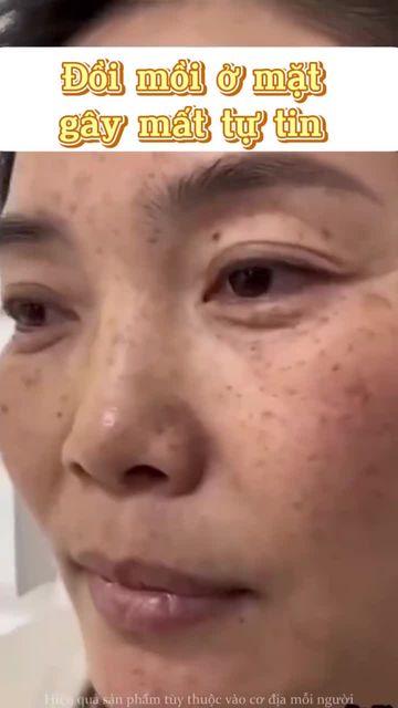 Kem Dưỡng Da Dr.Li