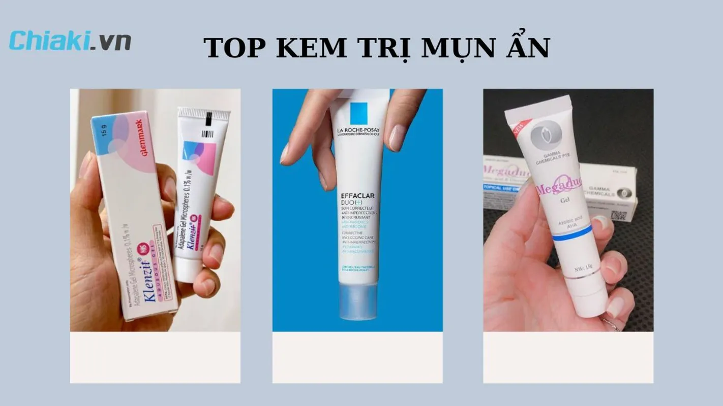THUỐC TRỊ MỤN ẨN ĐƯỢC CÁC BÁC SĨ DA LIỄU KHUYÊN DÙNG CHO DA MỤN