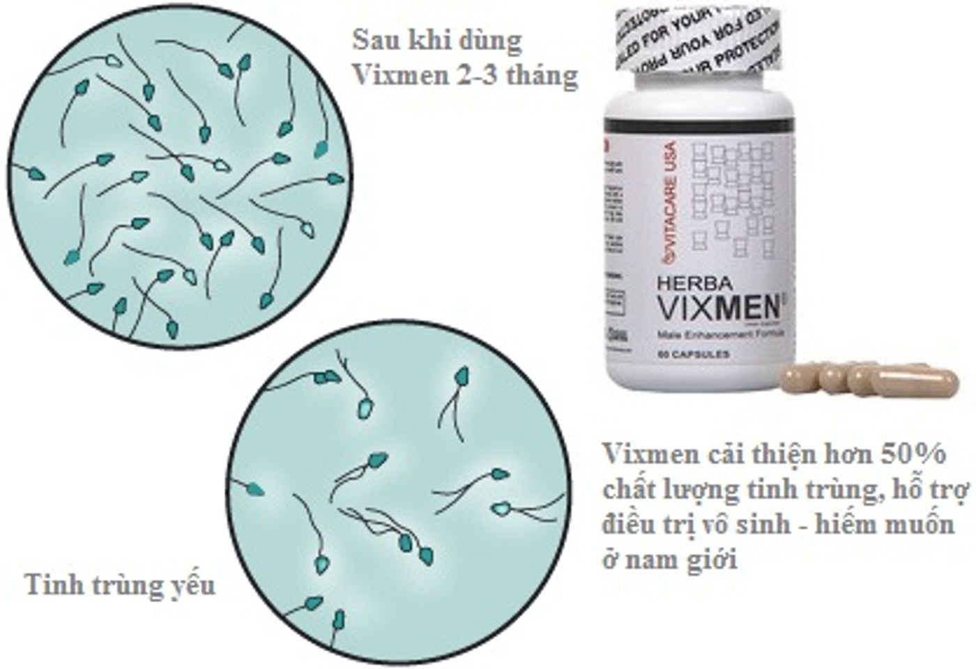 Herba Vixmen hỗ trợ điều trị vô sinh, hiếm muộn ở nam giới