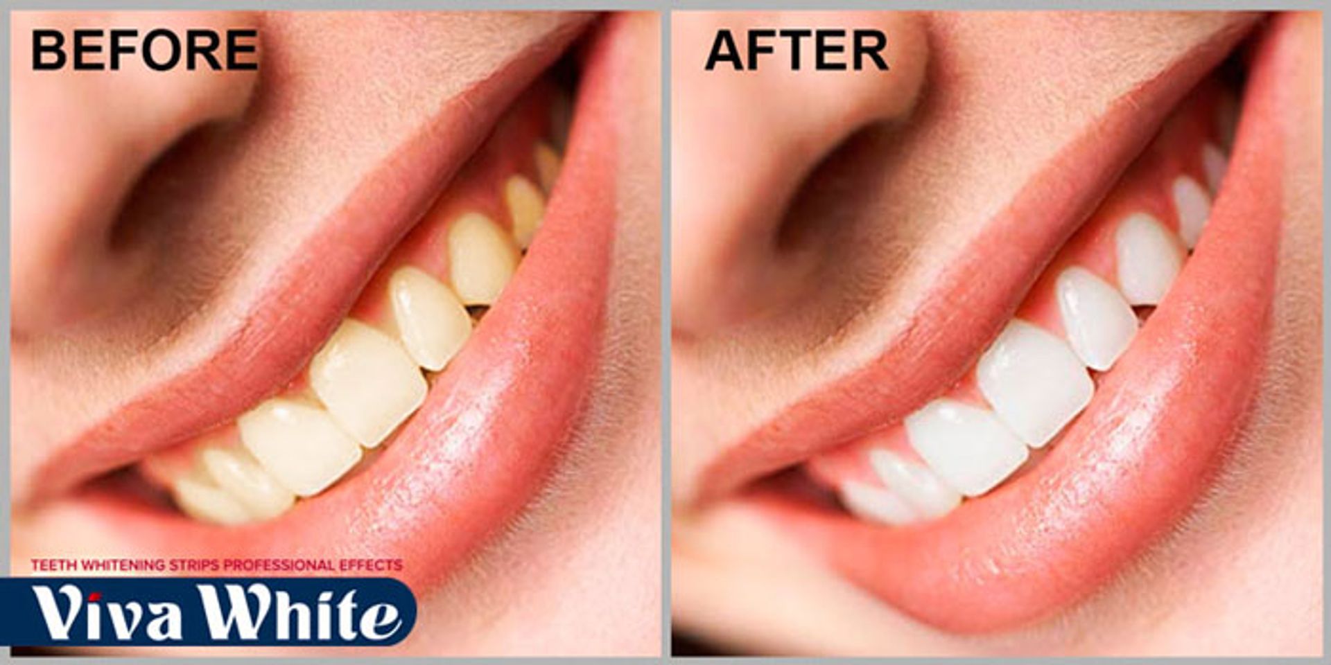 Miếng dán trắng răng viva white dễ dàng sử dụng và mang lại hiệu quả cao