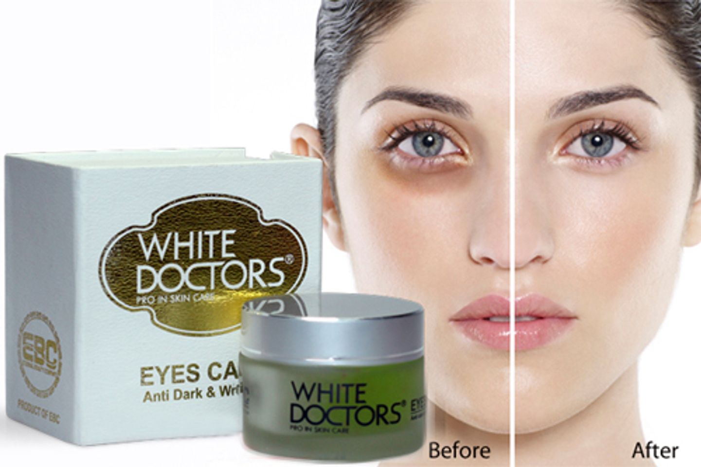 Kem Eyes Care White Doctors - đặc trị thâm quầng mắt của Mỹ