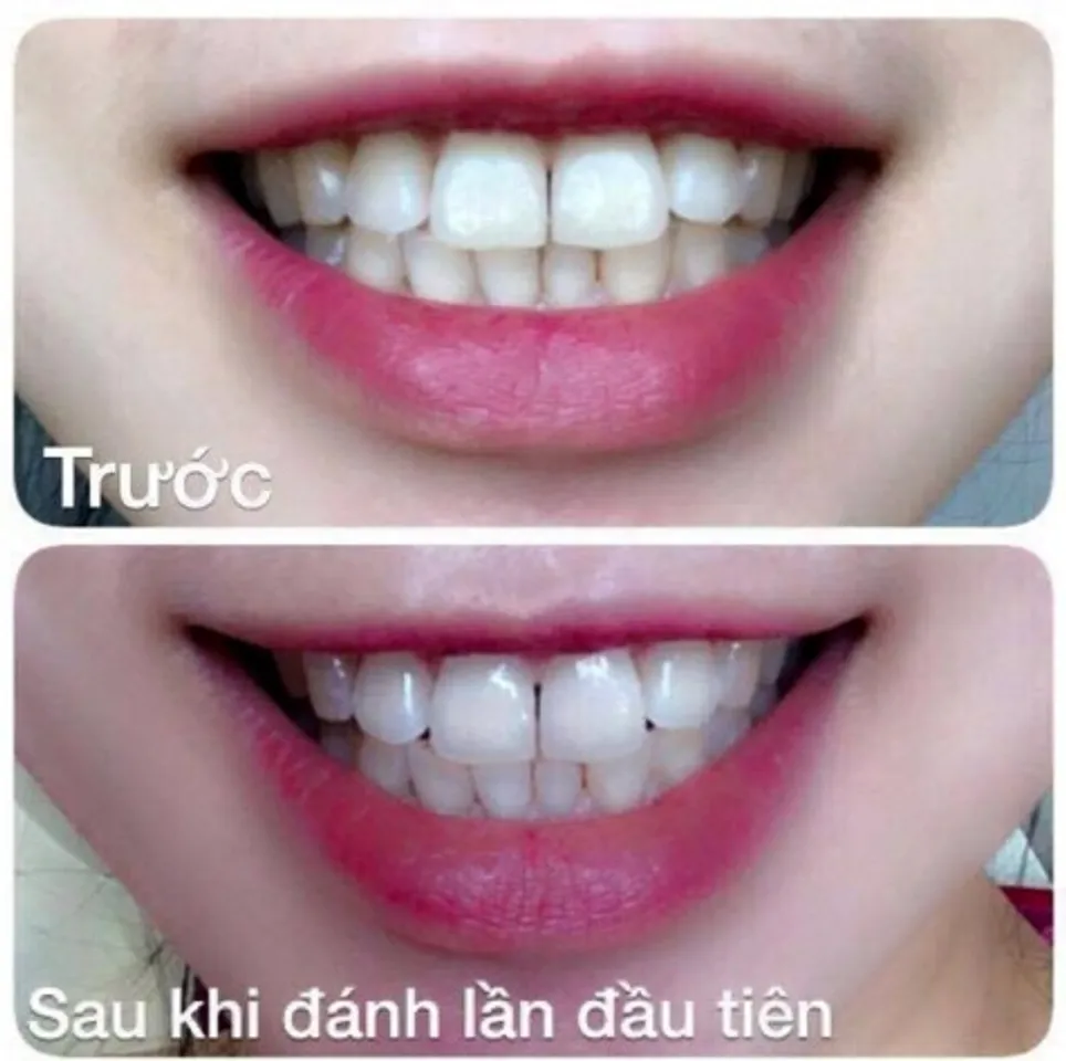 Phản hồi khách hàng sau khi sử dụng bột trắng răng Eucryl tooth powder