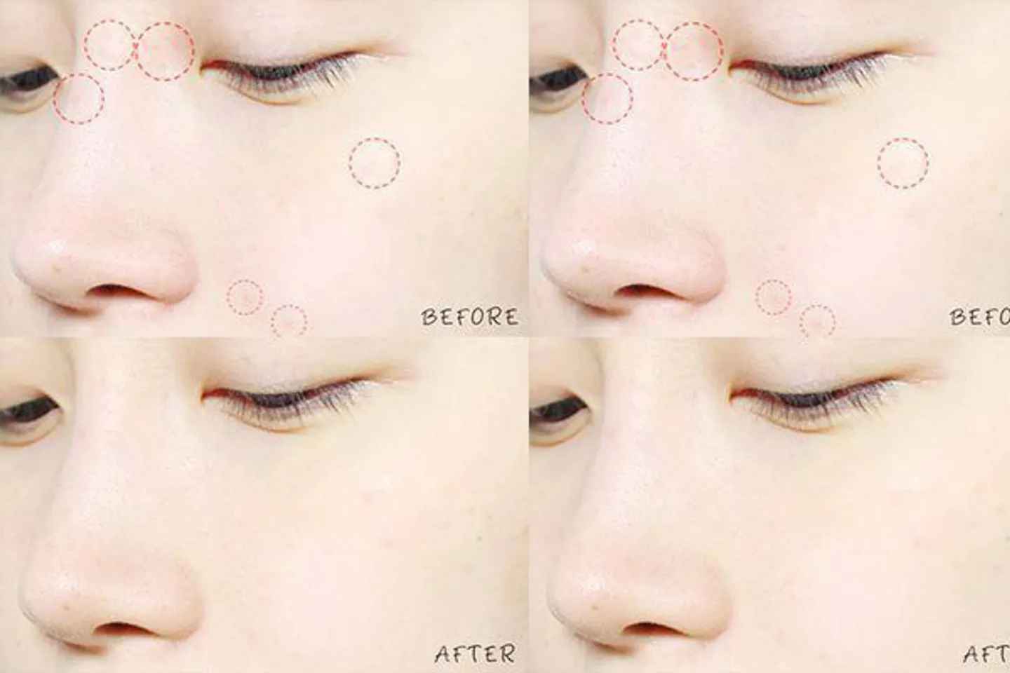 Công dụng của miếng dán mụn Cosrx acne pimple master patch