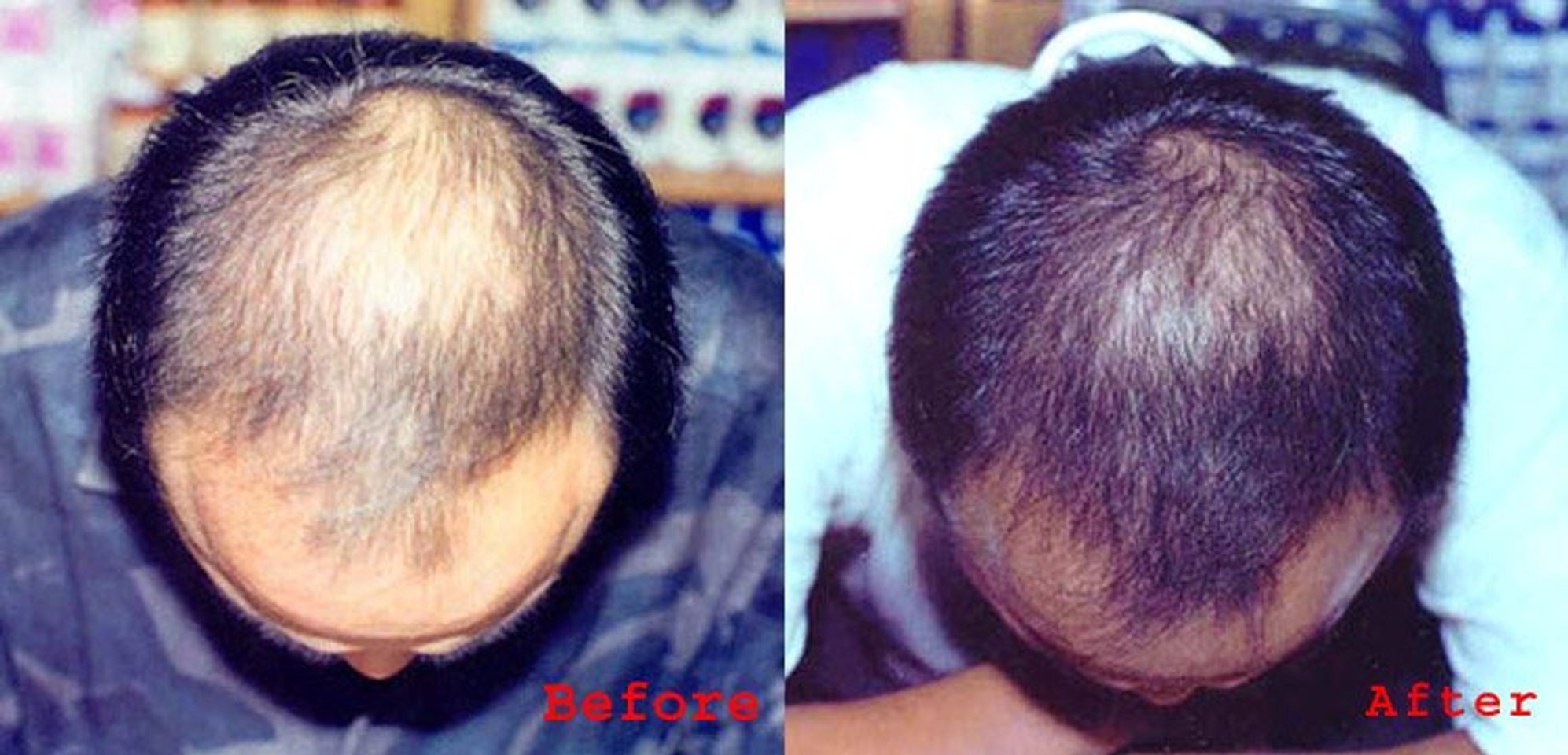 Natrol Biotin 1000 mcg hỗ trợ mọc tóc và tăng độ dày của tóc