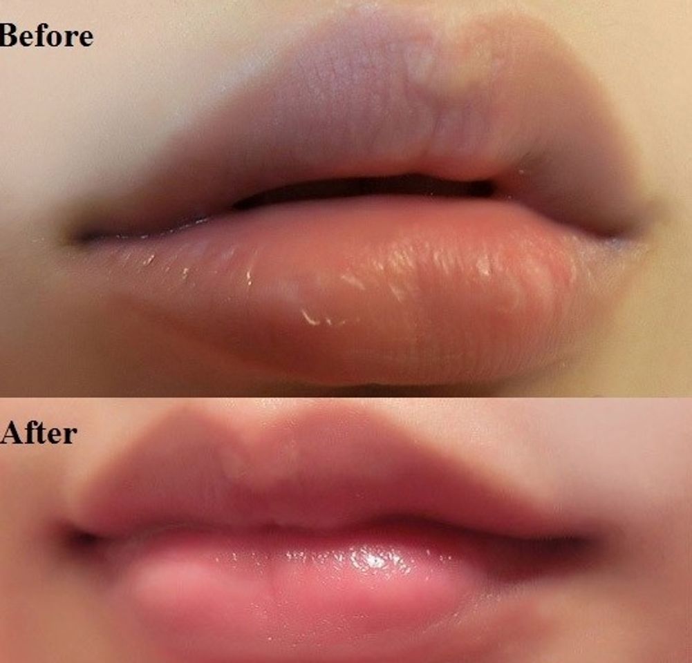 Hình ảnh trước và sau khi sử dụng tẩy tế bào chế môi The Face Shop
