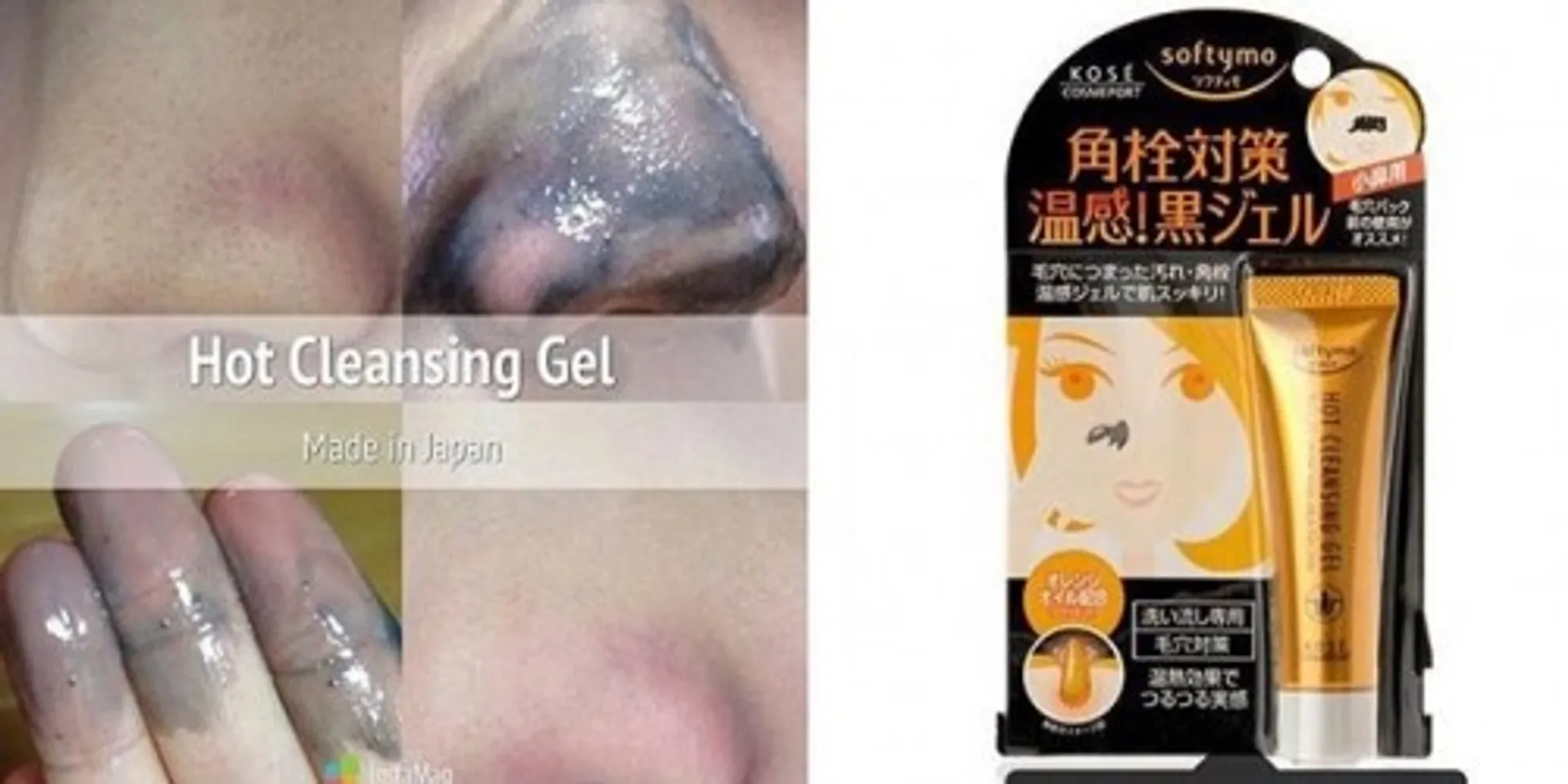 Kose Softymo Hot Cleansing Gel sẽ lột sạch nhân mụn ở các vùng da trên khuôn mặt bạn