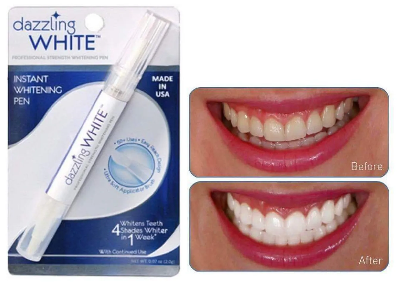 Bút tẩy trắng răng Dazzling White có khả năng làm trắng răng 4 cấp độ sau 1 tuần