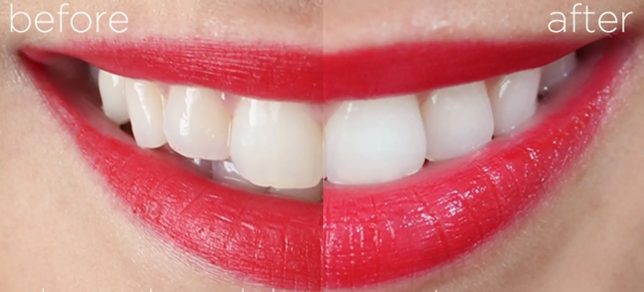 Cơ chế làm trắng răng của Crest 3D White Glamorous White là tạo lớp bọt dày bao phủ hàm răng trong quá trình đánh răng