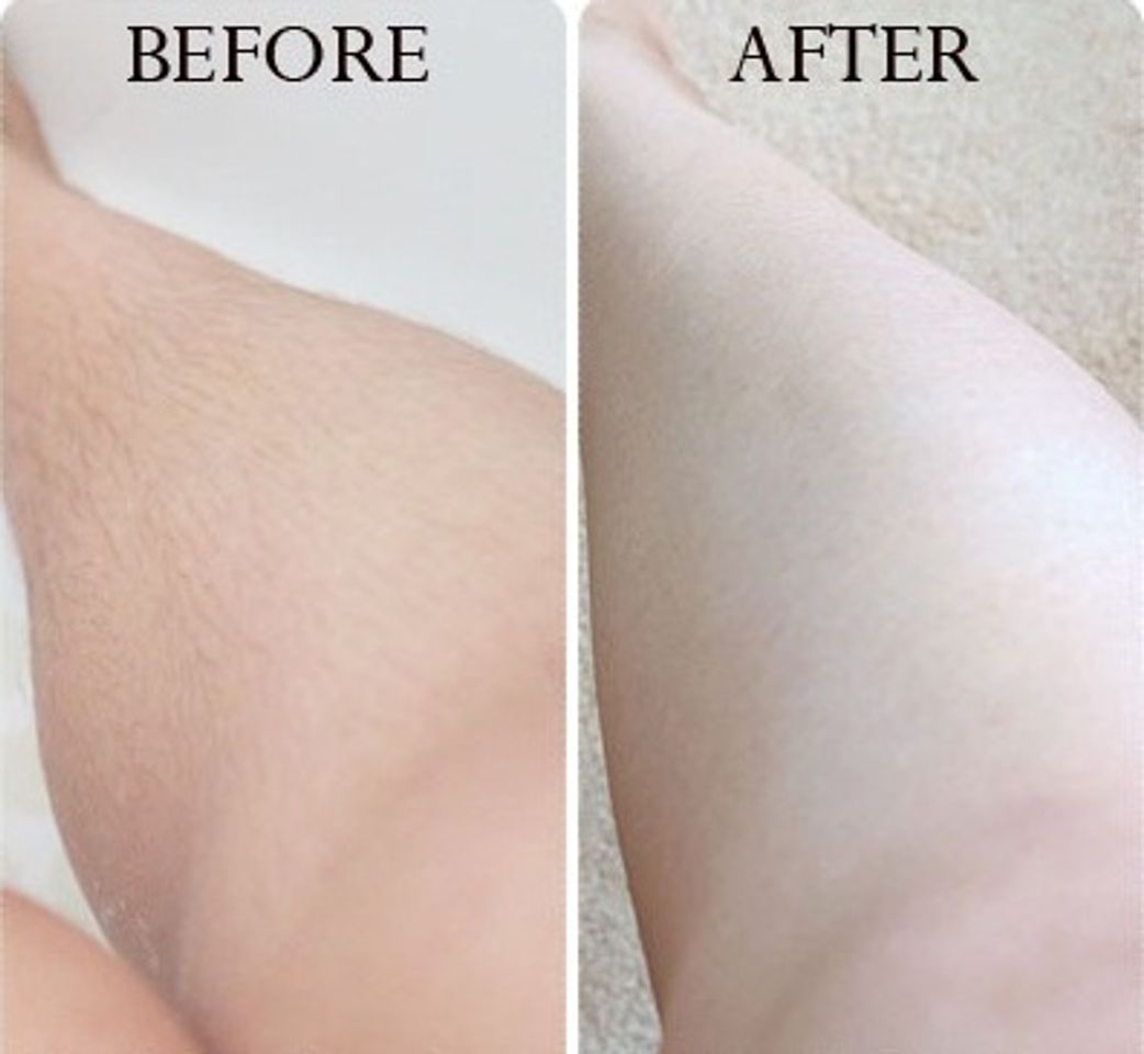 Kem tẩy lông Velvet mang lại hiệu quả và đảm bảo an toàn cho làn da
