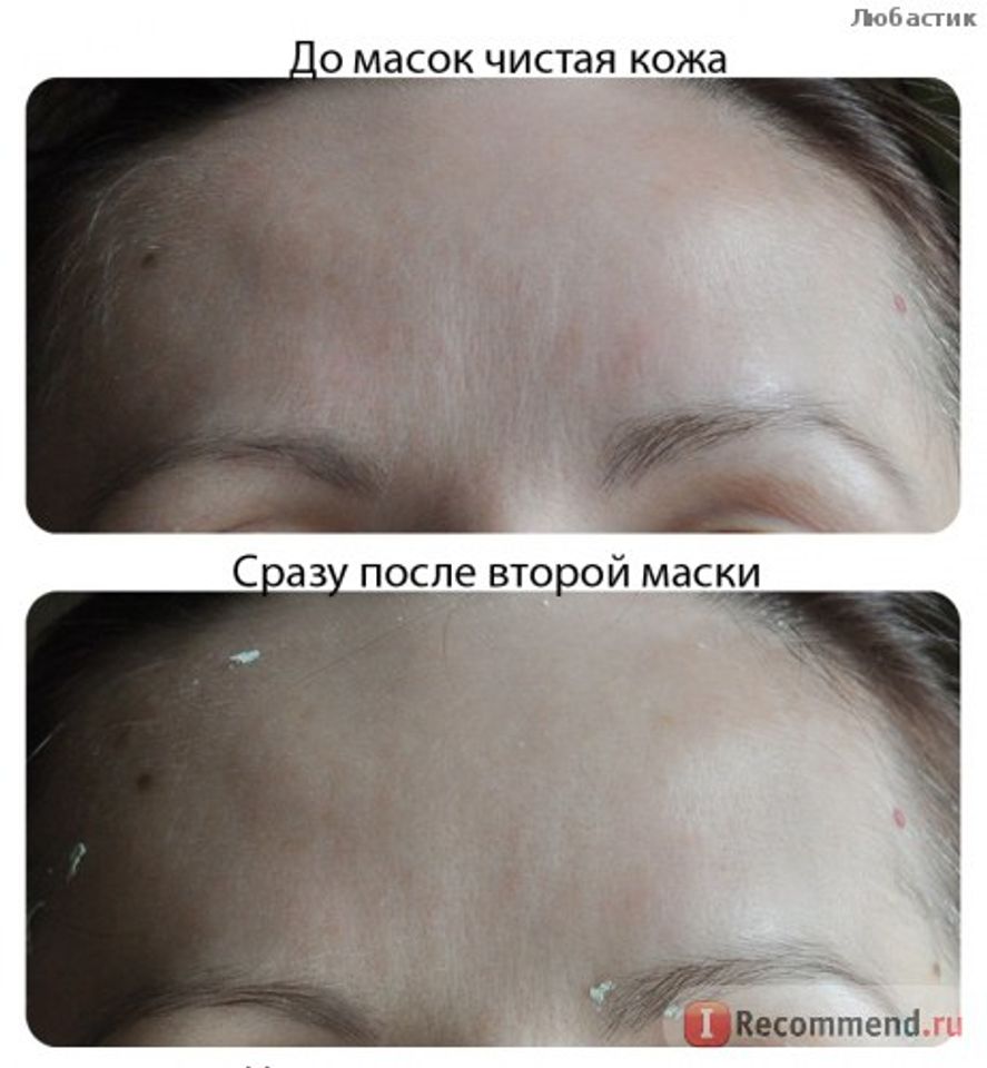 Collagen tươi Teana D6 của Nga chống chảy xệ cho phụ nữ từ tuổi 30 trở lên