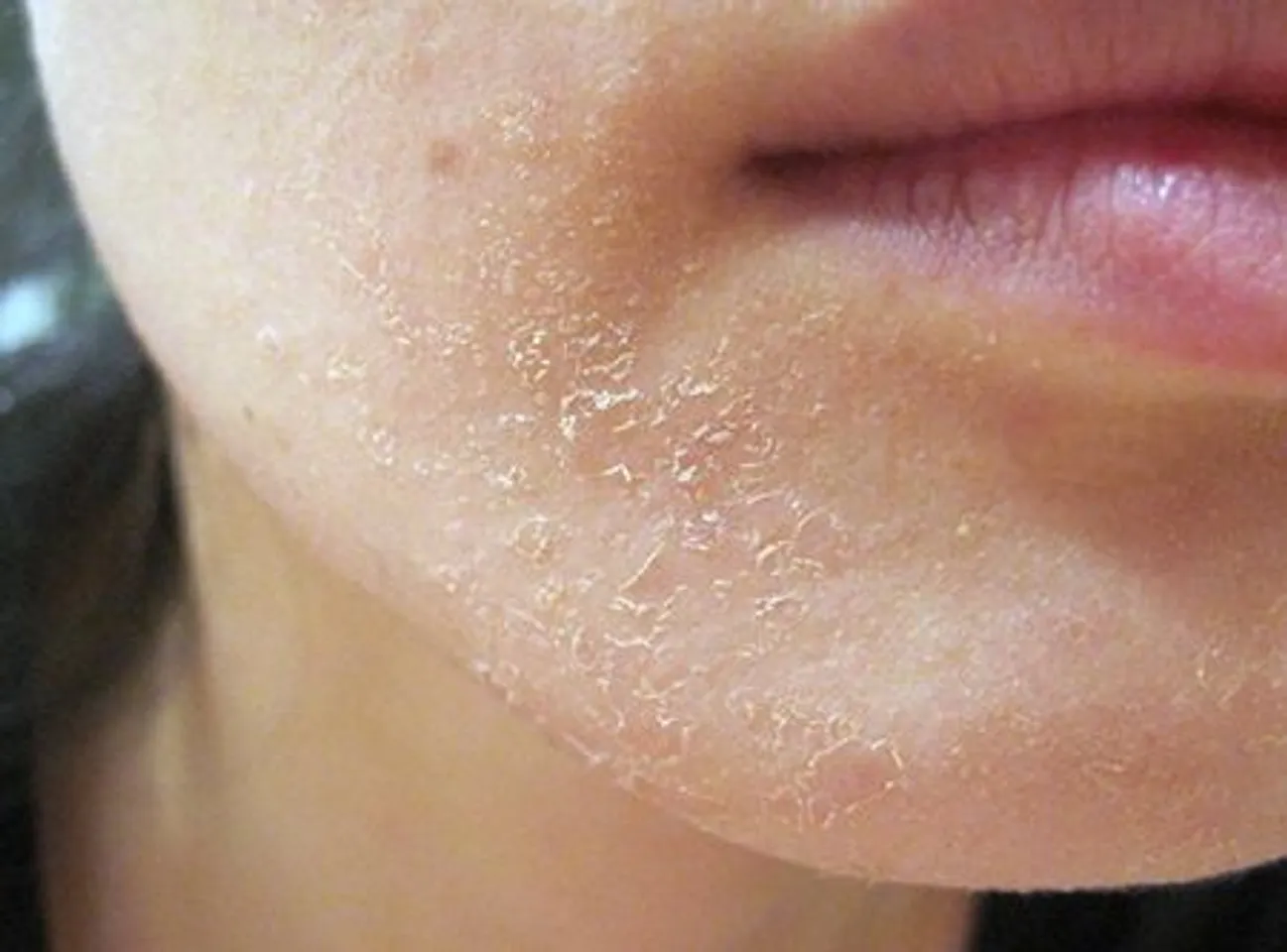 Kem dưỡng ẩm Eucerin này được khuyên dùng cho da thường đến khô, điều trị hiện tượng da khô nứt nẻ