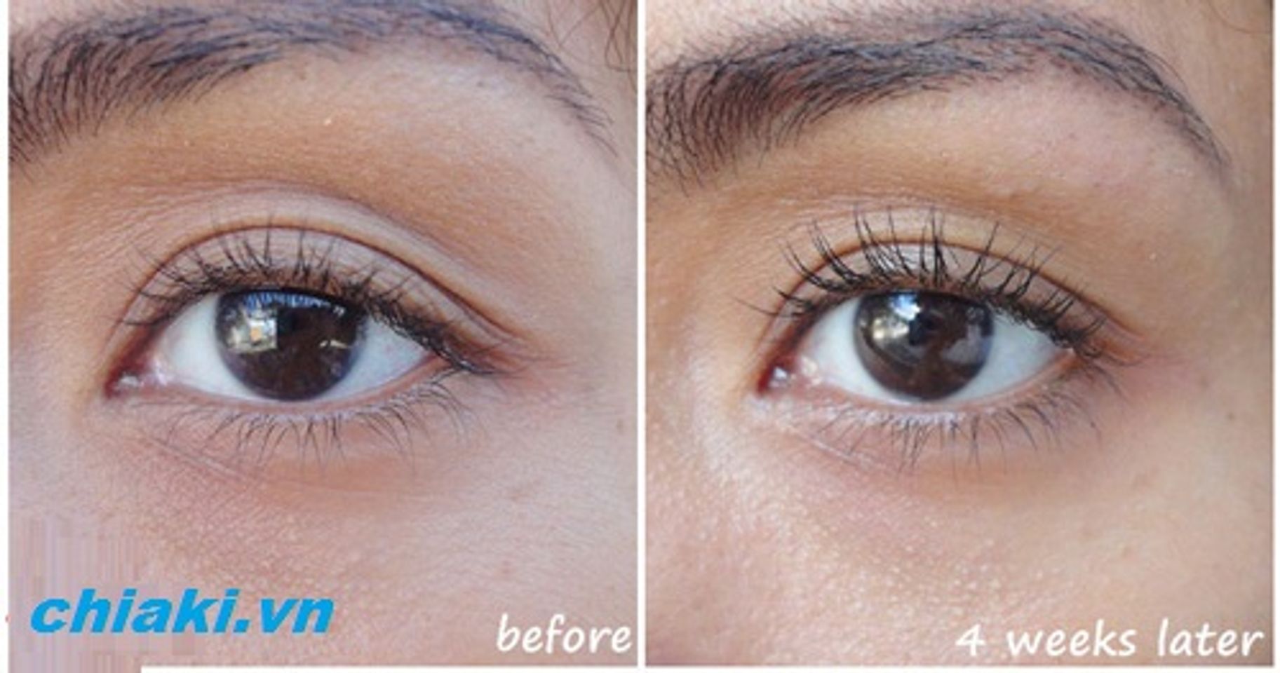 Kem dưỡng mắt Clinique giúp giảm và ngăn ngừa bọng mắt, quầng thâm và nếp nhăn quanh mắt hiệu quả