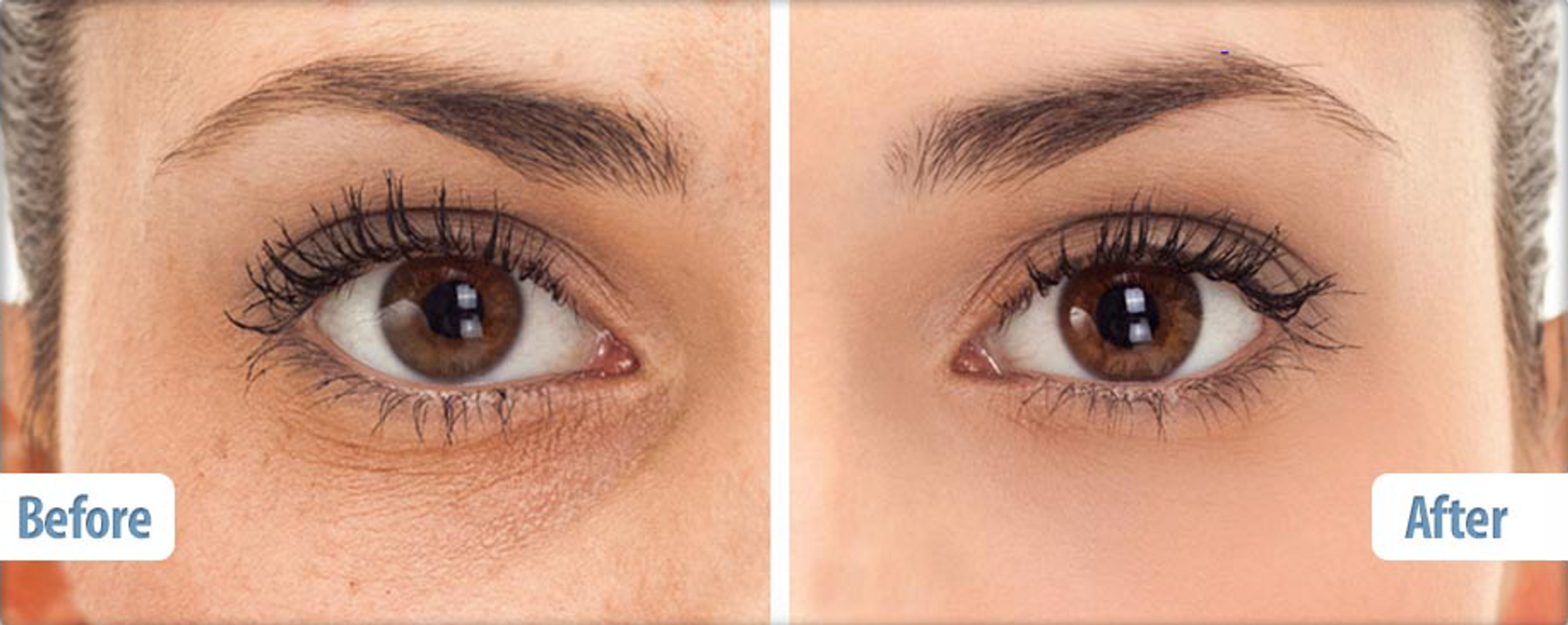 Kem mắt Balance Active Formula Snake Venom Eye Cream giúp làm mờ vết nhăn và thâm quầng mắt hiệu quả