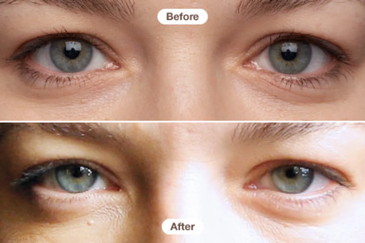 Kem mắt RoC giải quyết các vấn đề nhăn mắt và quầng thâm, mang lại hiệu quả giảm quầng thâm cùng bọng sau khoảng 1 tuần, còn nếp nhăn là sau khoảng 3 tháng