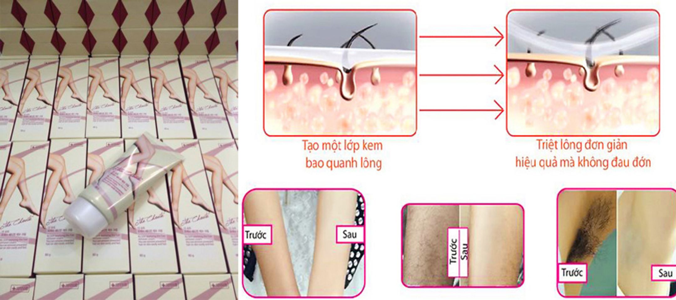 Kem tẩy lông iCharming The choute Hàn Quốc giúp tẩy sạch lông mà không gây tổn thương da