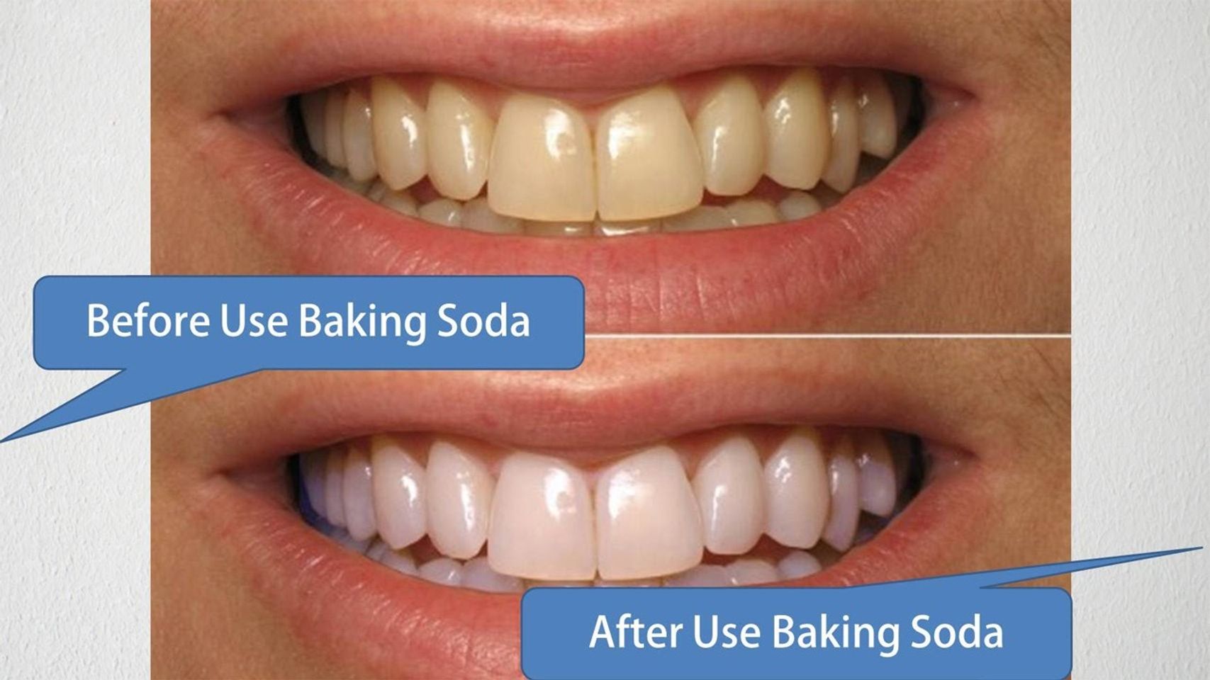 Bột Baking Soda giúp tẩy trắng răng, sạch miệng