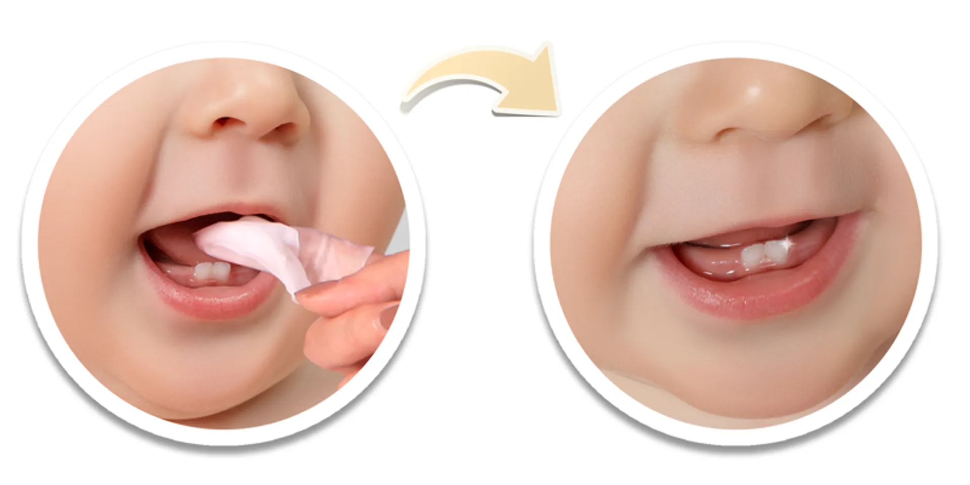 Cách sử dụng gạc BaBy Bro vệ sinh răng miệng cho bé