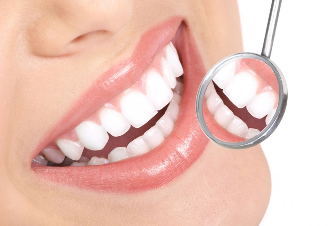 Sensodyne Extra Whitening là sản phẩm được các bác sỹ nha khoa khuyên dùng cho răng và nướu nhạy cảm