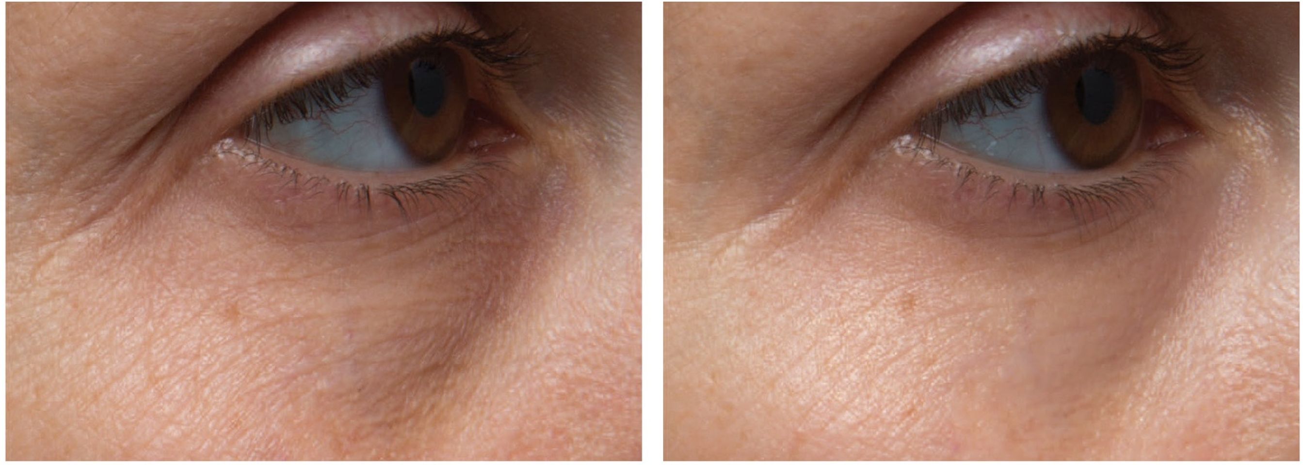 Kem dưỡng mắt Alpha Skincare Nourishing Eye Cream 2