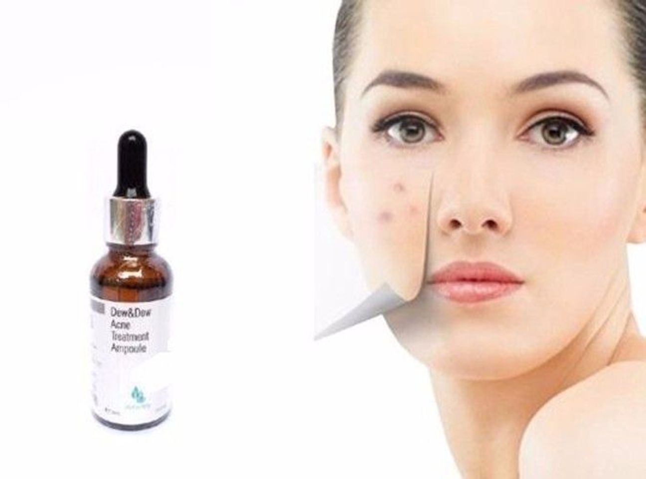 Serum đặc trị mụn Dew & Dew Acne Treatment Ampoule 2
