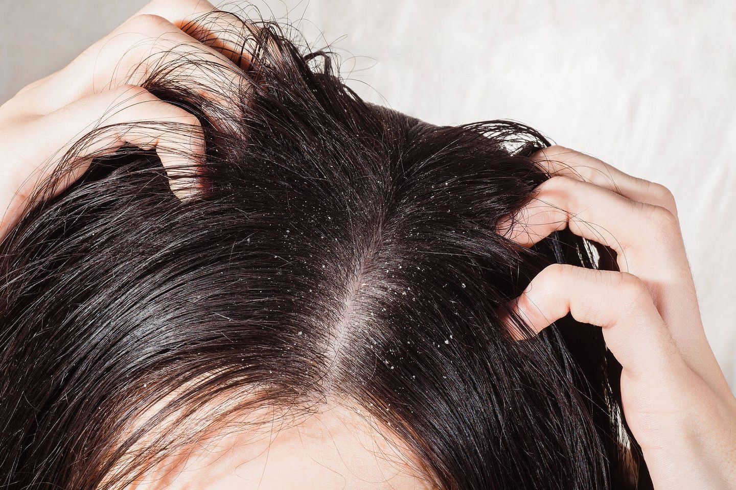 Lựa chọn dầu gội kích thích tóc nhanh dài phù hợp với loại da đầu