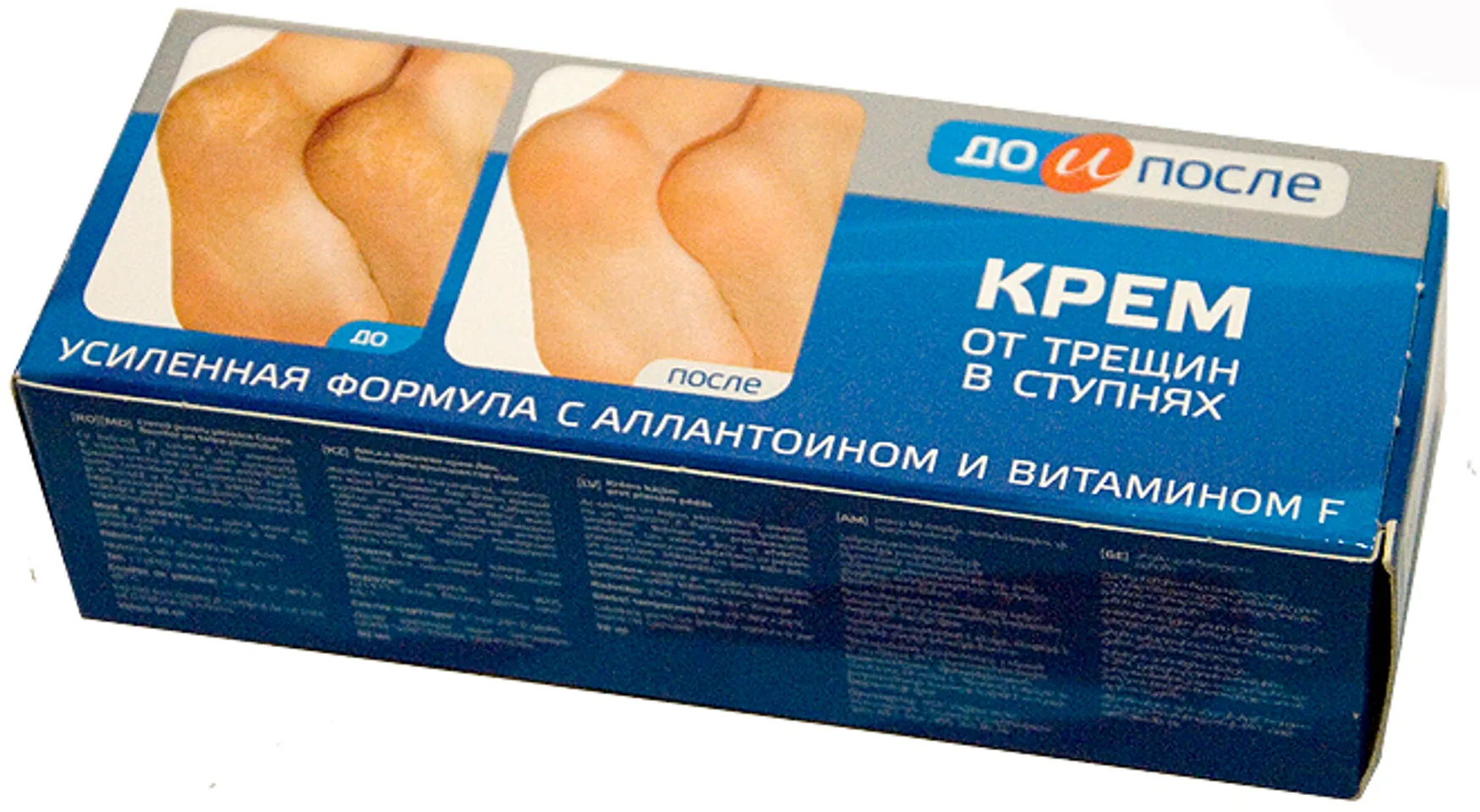 Kem hỗ trợ cải thiện nứt gót chân Kpem Apteka của Nga 50ml 3