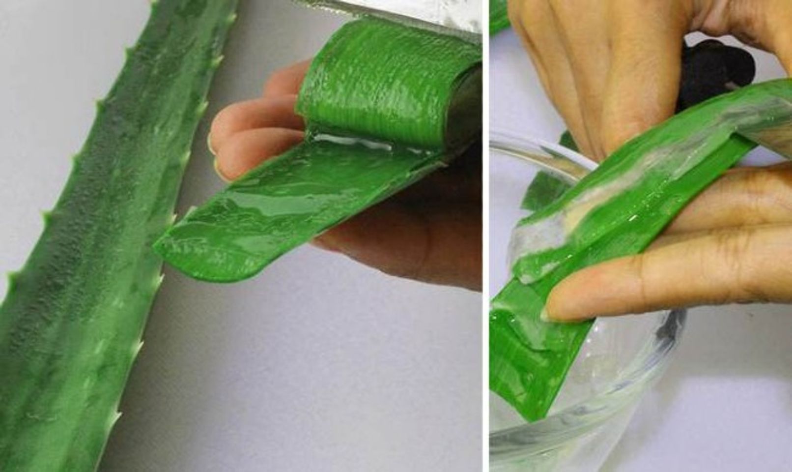 Mách bạn 10 cách trị sẹo hiệu quả tại nhà