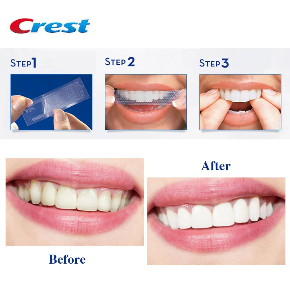 Hướng dẫn sử dụng miếng dán trắng răng Crest 3D White Professional Effects