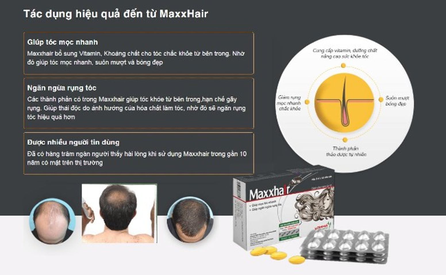 ưu &dstrok;iểm ch&iacute;nh của Maxxhair m&agrave; bạn n&ecirc;n biết