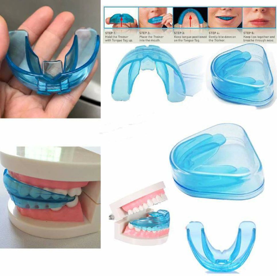 Sử dụng niềng răng Trainer cho người lớn 3 giai đoạn dễ dàng