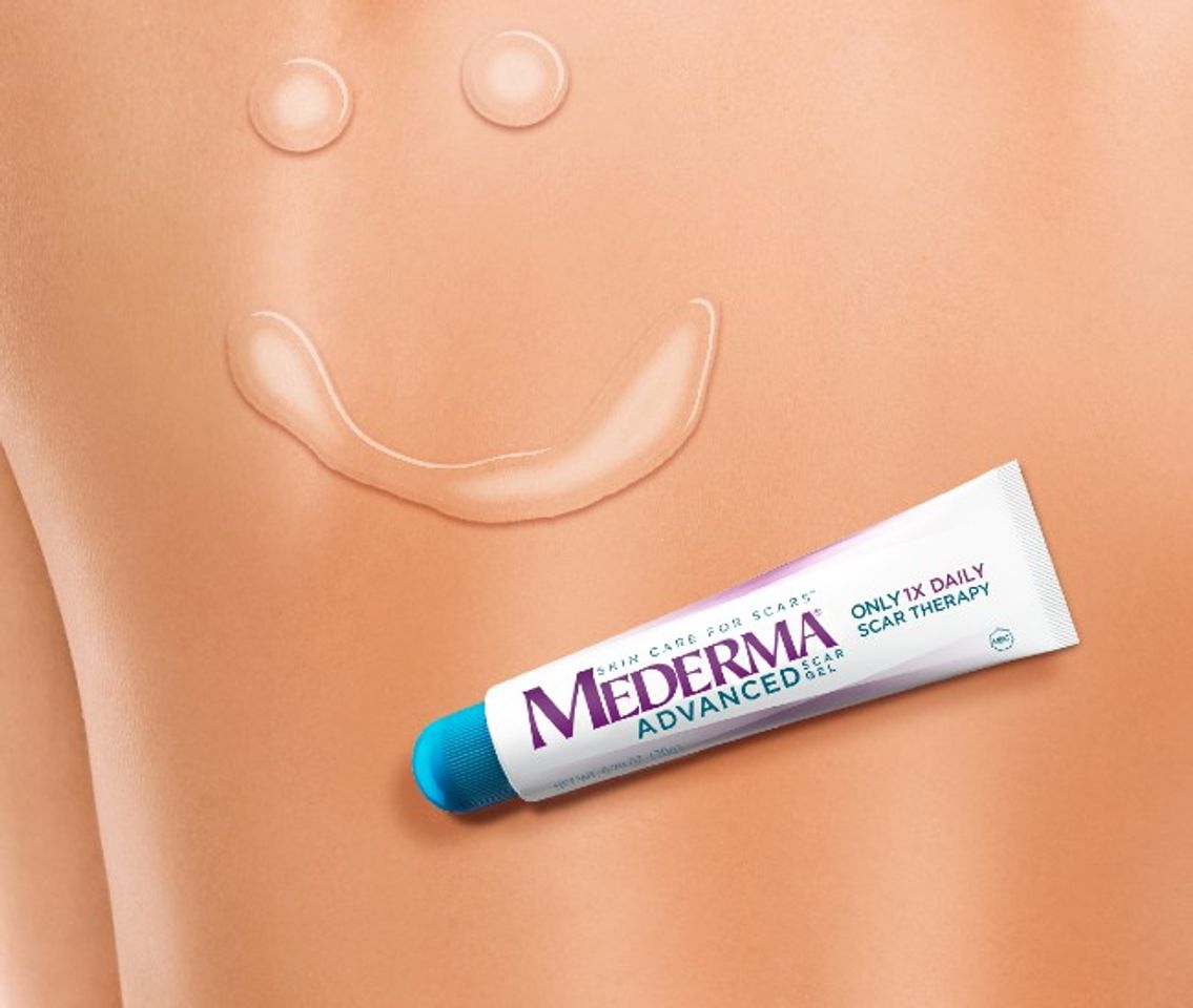 ưu &dstrok;iểm của Mederma Advanced Scar Ge