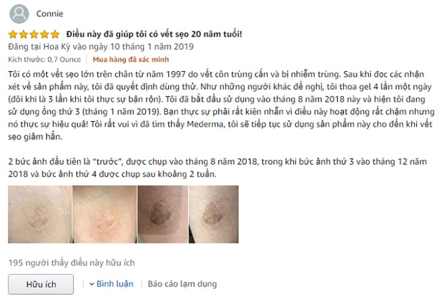 Mederma Advanced Scar Gel Reviews từ người sử dụng 1