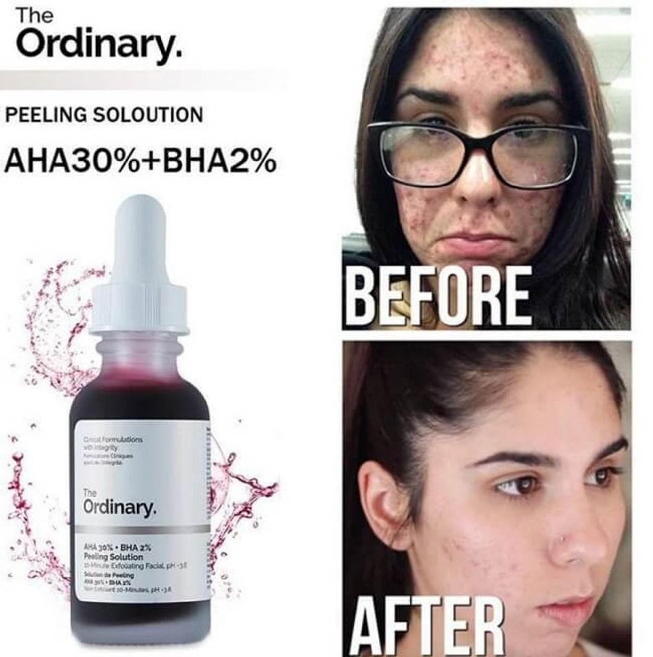 ưu điểm của Serum The Ordinary AHA 30% + BHA 2% Peeling Solution