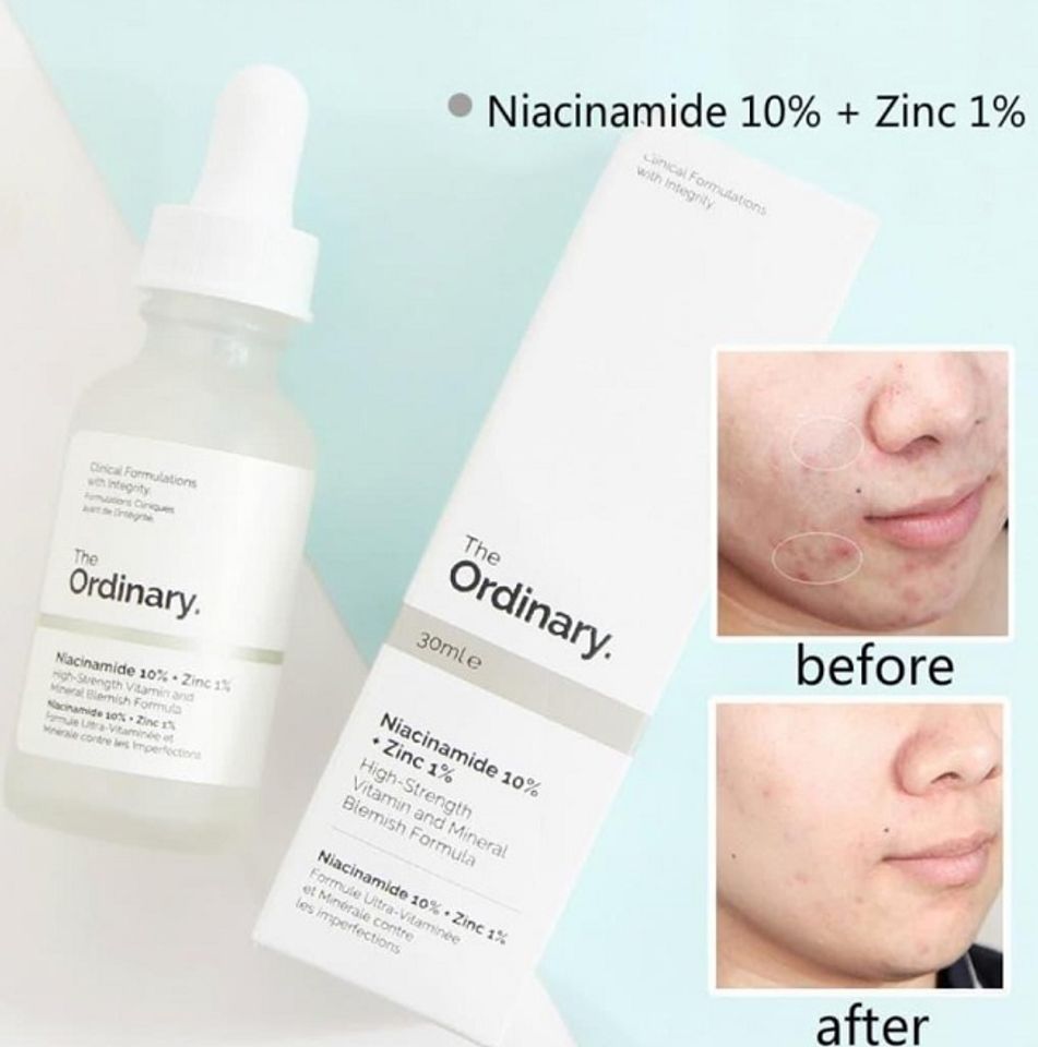 ưu điểm của Serum The Ordinary Niacinamide 10% + Zinc 1%