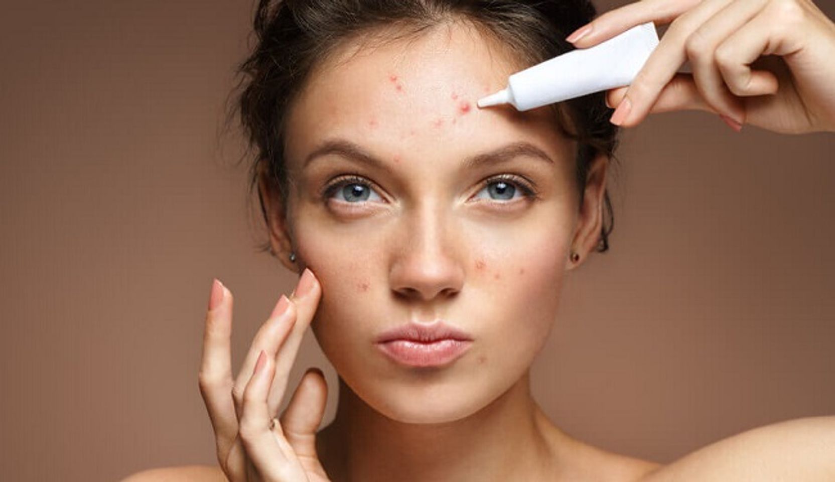 ưu điểm của axit salicylic gi&uacute;p ngăn ngừa mụn đầu trắng v&agrave; mụn đầu đen