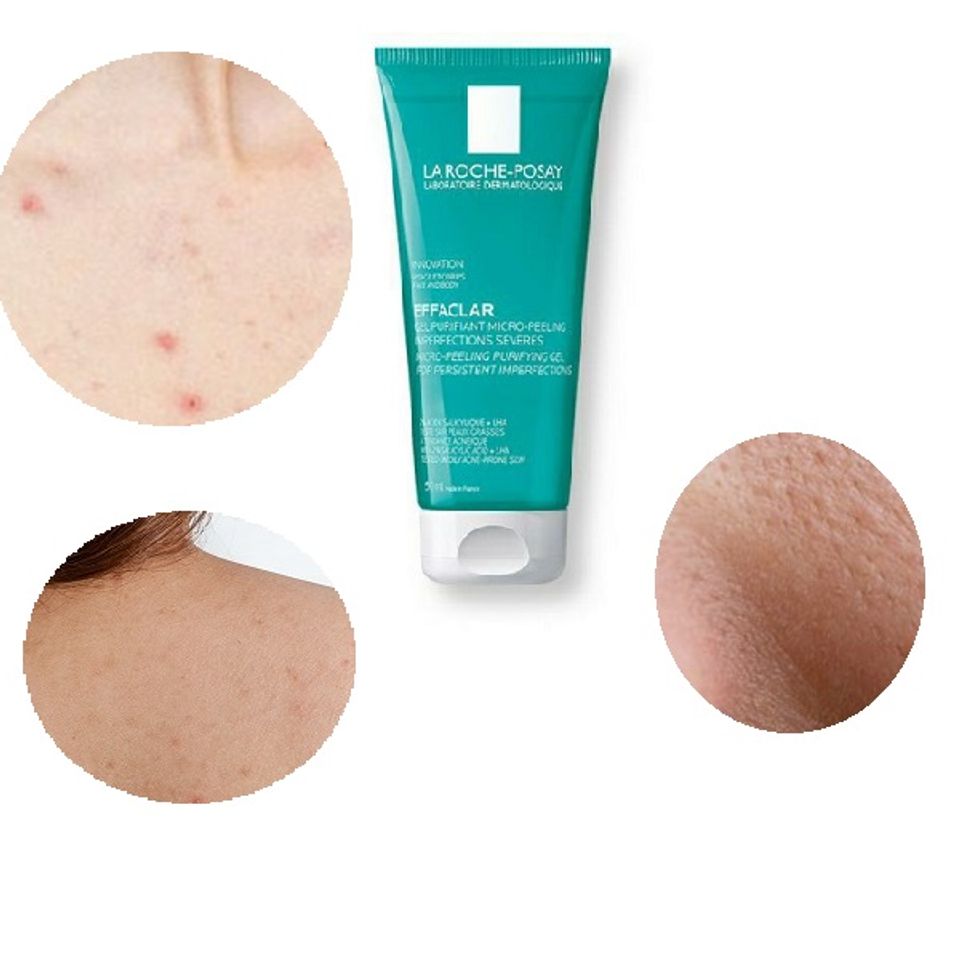 Gel La Roche Posay Effaclar Micro-Peeling làm sạch nhờn da mặt, ngực, lưng